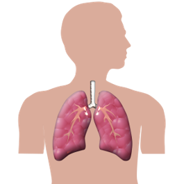 ER lungs.png