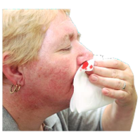 Mouth bleeding