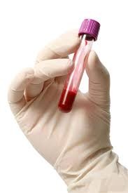 Blood test - temp image