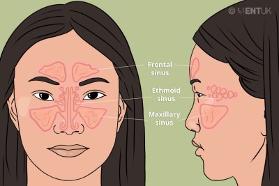 sinus.jpg