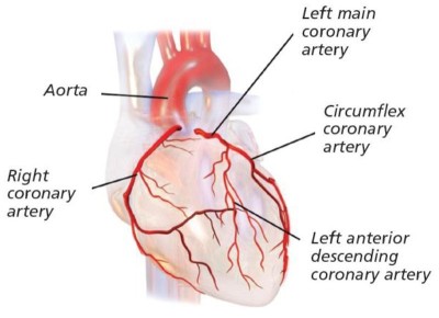 coronary arteries image showing (clockwise from bottom left): right coronary artery, aorta, left main coronary artery, circumflex coronary artery and left anterior descending coronary artery