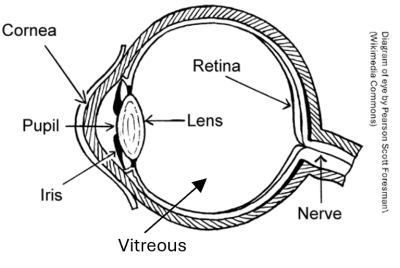 Endophthalmitis image of eye.png