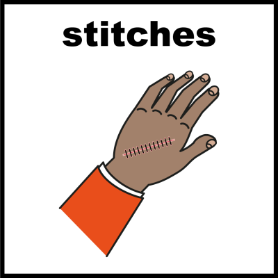 Stitches